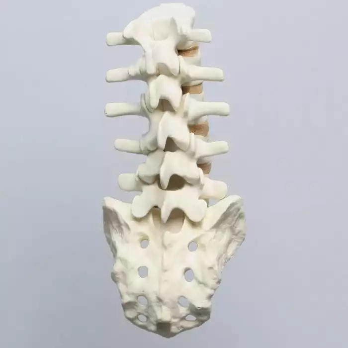 Spine, Lumbar, L1-Sacrum with Tan Discs, Solid Foam