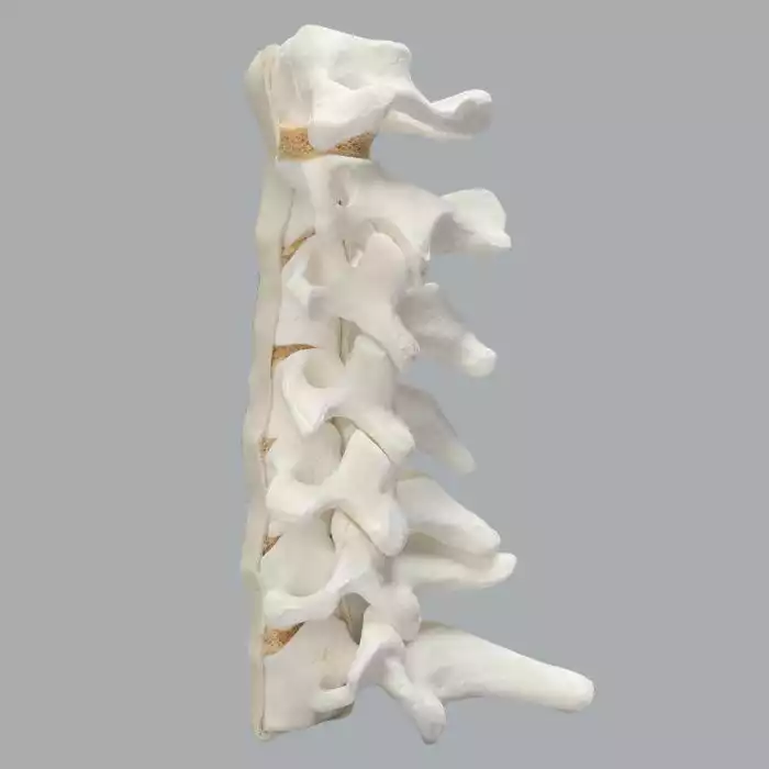 Spine, Cervical, Anterior and Posterior Ligaments, Solid Foam