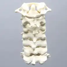 Spine, Cervical with Posterior Ligament, Solid Foam