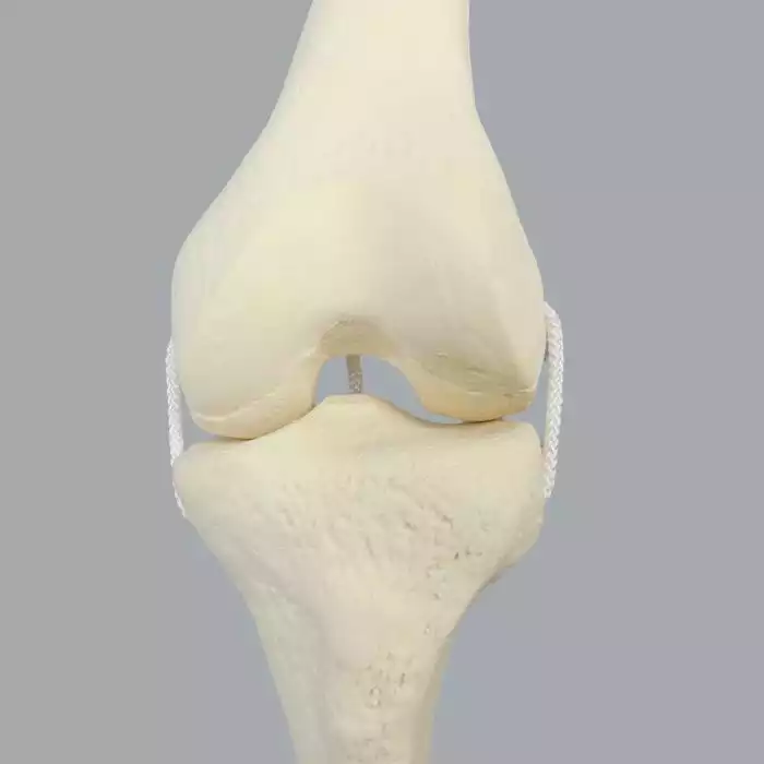 Knee with Three Nylon Non-Stretch Ligaments and Narrow Intercondylar Notch, Full Length