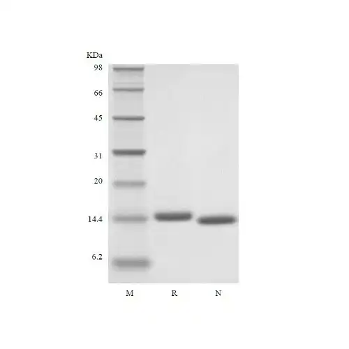 Recombinant Human Interleukin IL-2 / 면역세포 증식용 Cytoikine