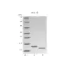 IL-15, Recombinant Human Interleukin/ 면역세포 증식용 Cytoikine