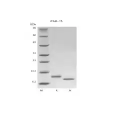 IL-15, Recombinant Human Interleukin/ 면역세포 증식용 Cytoikine